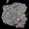 A broadband SRS image of human head and neck tumour tissue with scale indicated 