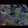 A Raman image of tissue from a human head and neck cancer, indicating the chemical makeup.